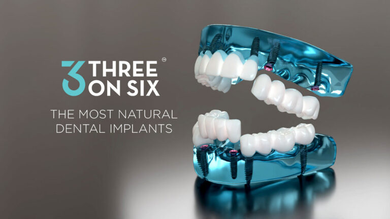 3-on-6™ Dental Implants